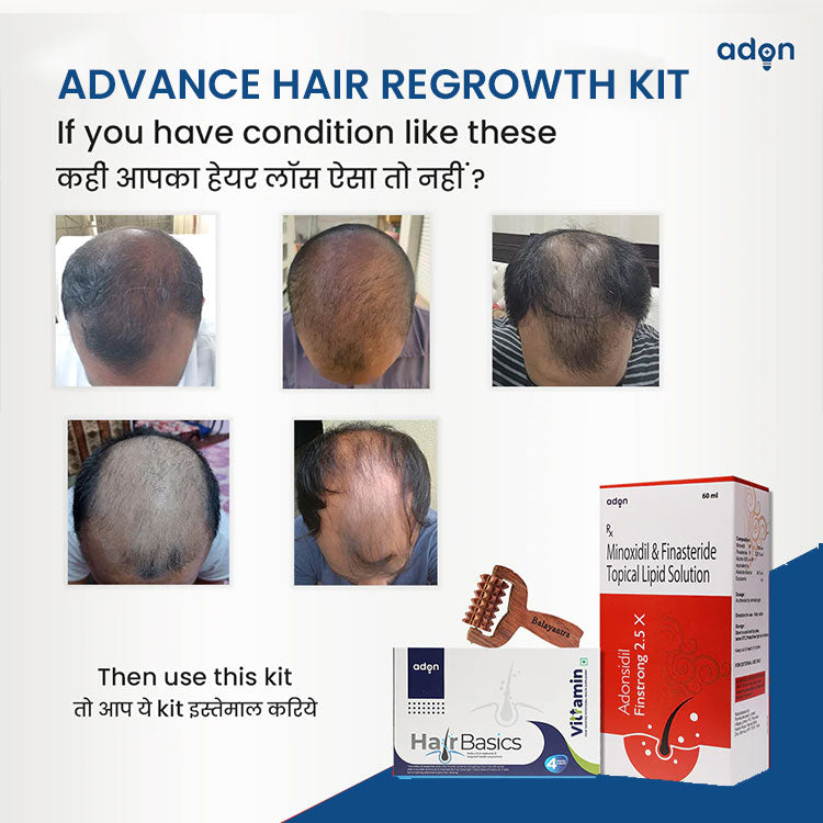 Advance Hair Regrowth Kit