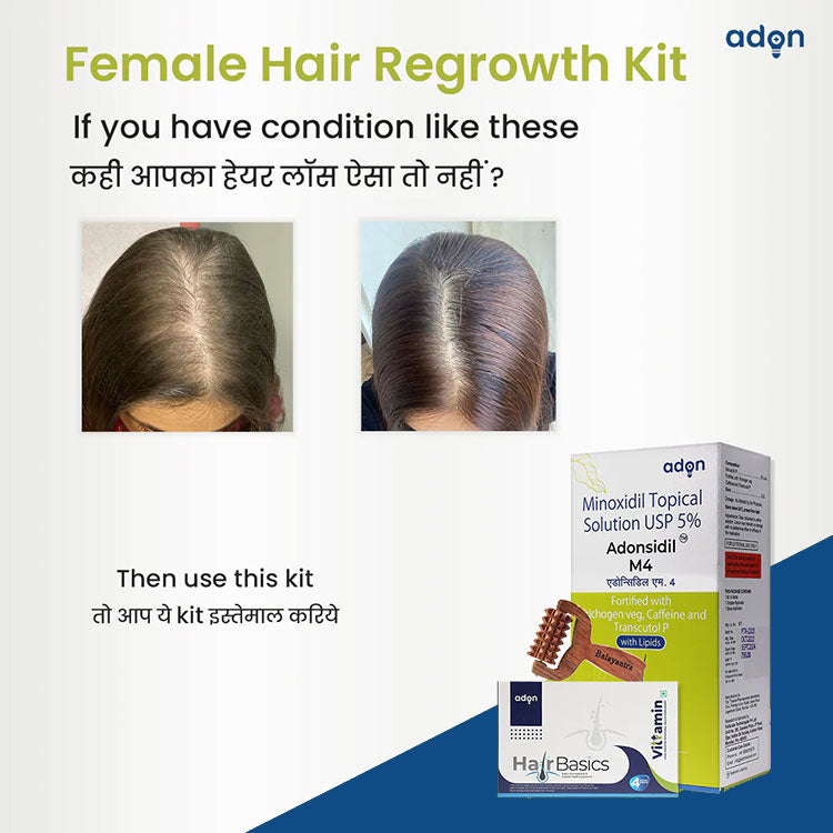 Female Hair Regrowth Kit