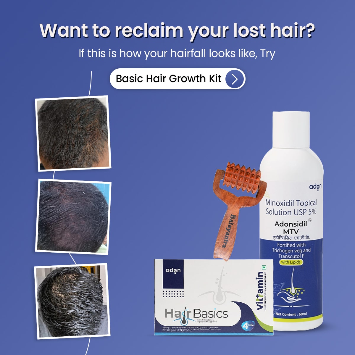Basic Hair Growth Kit