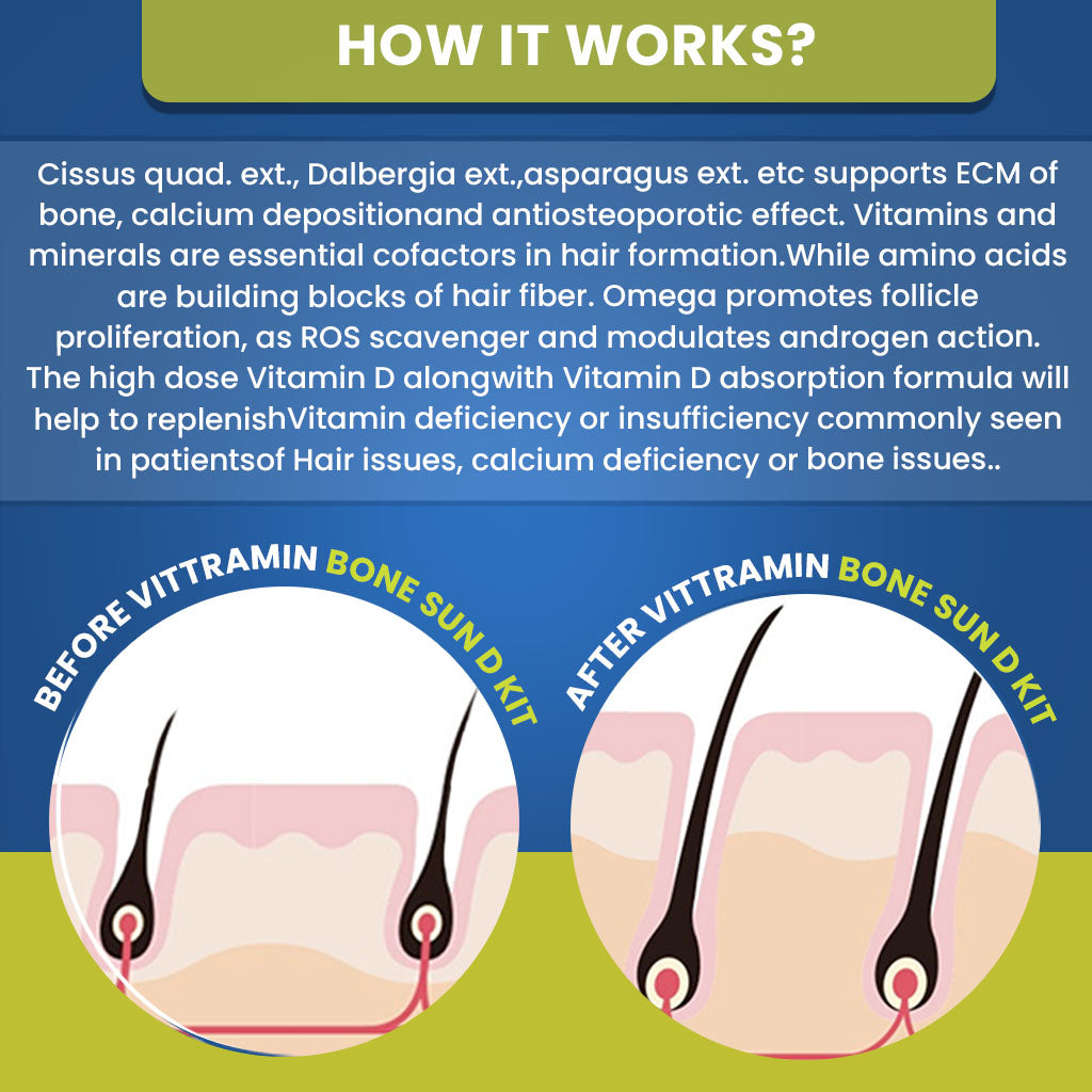 Vittramin Bone Sun D Kit